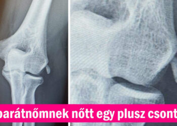 17 kép, amelytől kikerekedett a szemünk a hitetlenkedéstől