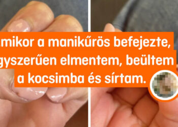 15 lány, aki egy kicsit szebb akart lenni, de valami közbejött