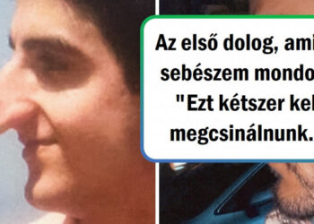 18 személy, akik a plasztikai műtétet választották, hogy megváltoztassák a kinézetüket és javítsanak az önbecsülésükön