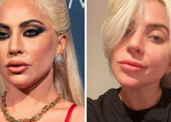 15 sztár szelfi, ami lerántja a leplet a tökéletesnek tűnő világunkról