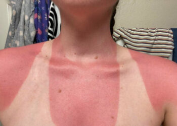 16 alkalom, mikor az emberek a saját figyelmetlenségük miatt kerültek bajba