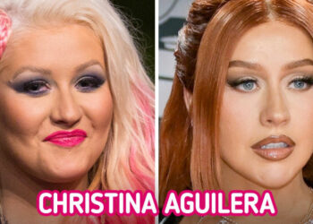 15 sztár, aki megmutatta, hogy pár kiló leadása hogyan alakíthatja át az arcodat