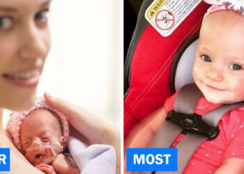 15 akkor és most fénykép, mely felnyitja a szemed a változás erejére