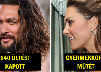 9 világhírű személy és a nem annyira híres sebhelyeik története