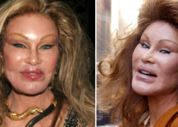 Ilyen a “Macskanő” milliárdos szocialista élete: “Soha nem estem át plasztikai műtéten”