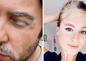 15+ személy és állat lélegzetelállító tulajdonságokkal, melyek miatt még jobban csodáljuk ezt a világot