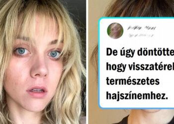 15+ személy, akik abbahagyták az öröklött gyönyörű hajuk rejtegetését