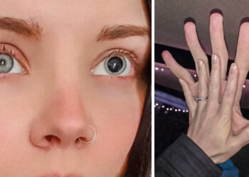 13 váratlan eset, ahogy a tested meglephet téged