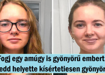 15 lány, akik leborotválták a fejüket és sokkal ellenállhatatlanabbak lettek