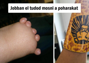 15 személy, aki a legsötétebb napokon is megtalálja a napsütést