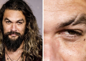 8 sztár, akik jól érzik magukat egyedi szépségjegyeikkel