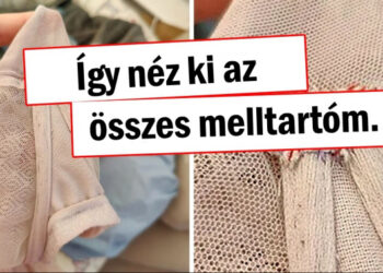 16 nő, akik összeszedtek egy kis bátorságot és megosztották a legnevetségesebb szépséghibáikat