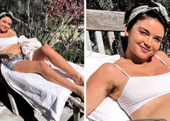 13 sztár, akik emlékeztetnek bennünket, hogy a szépség nem egyenlő a tökéletességgel