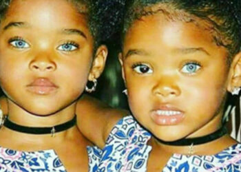 A “Kék ikrek” meghódították a világot, és világszerte címlapokra kerültek. Ma így néznek ki