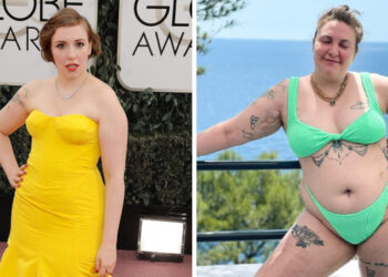 Így inspirálja Lena Dunham az embereket, hogy beleszeressenek az idomaikba és a hegeikbe