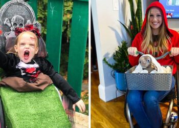 10 személy, akik nem hagyták, hogy a fogyatékosságuk lerombolja a halloweeni hangulatukat