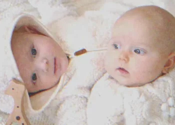 Az 54 éves hölgy ikreket szül, veje ismerős anyajegyeket lát rajtuk