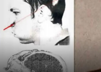 Az ember története, akinek a fejét egy részecskegyorsító nyaláb szúrta át és túlélte!