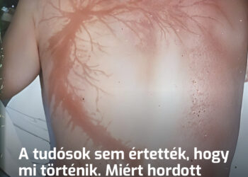 A tudósok sem értették, hogy mi történik. Miért hordott magával mindig vizet az a különleges ember, akibe hétszer csapott bele villám?