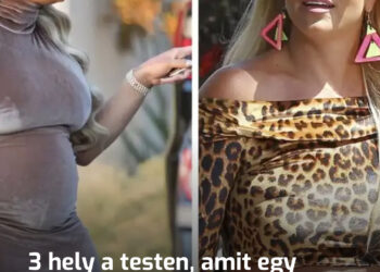 3 hely a testen, amit egy stílusos nő elrejt a ruha alá, míg egy nő, aki nem tudja, hogy kell öltözni, kiteszi