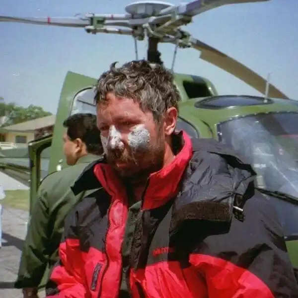 1996-os Mount Everest tragédia, amputáció, Beck Weathers, emberi kitartás, fagyás, hegymászás, inspiráló történetek, katasztrófa, Mount Everest, túlélés