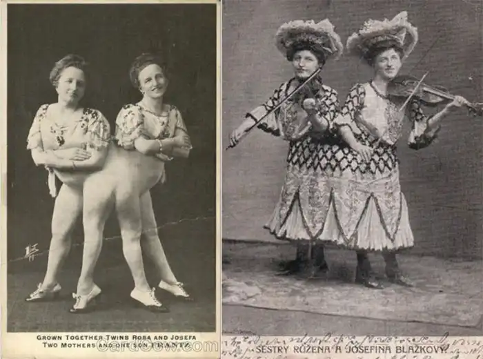 Cirkusz, család, Etika, kihívások, különlegesség, orvostudomány, Sorsok, Sziámi ikrek, társadalom, történelem