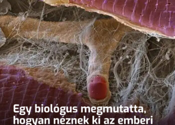 Egy biológus megmutatta, hogyan néznek ki az emberi test szövetei, ha elektronmikroszkóppal nézzük őket