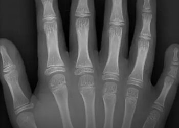 25 hihetetlen fotótény a világ minden tájáról, amit nehéz elhinni