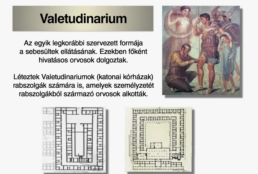 ellátás, hadsereg, hadviselés, Katonák, Koraújkor, középkor, Ókor, Orvoslás, Sebesültek, történelem