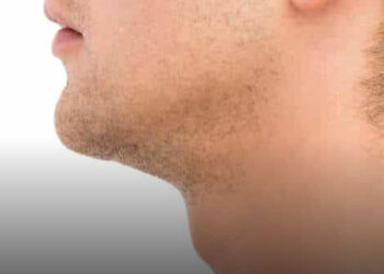 Ádámcsutka: Mi ez, és miért van a férfiaknál, de a nőknél nem?