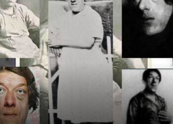 Mary Ann Webster: A világ legrondább nője, akinek története sokkoló