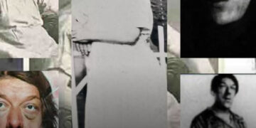 Mary Ann Webster: A világ legrondább nője, akinek története sokkoló