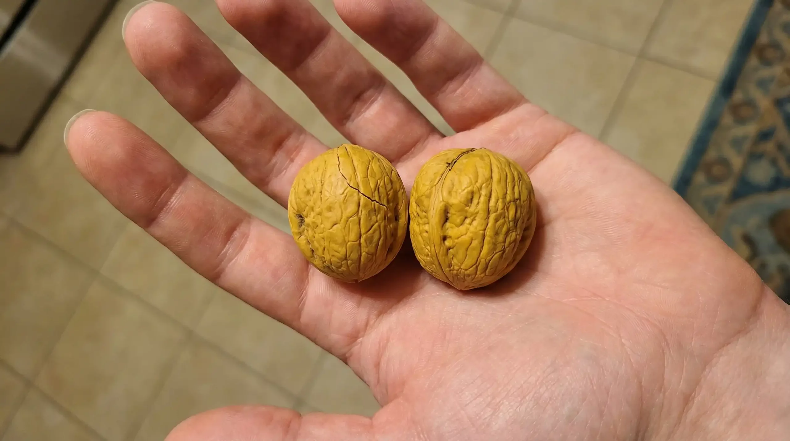agytorna, dió, egészség, Egyensúly, életmód, hagyomány, ízületek, megelőzés, stressz, szerencse