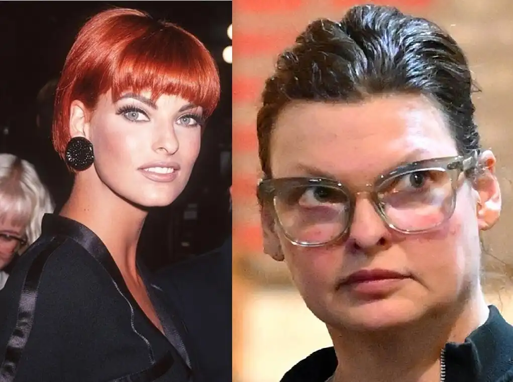 alakformálás, Cindy Crawford, divat, galéria, Linda Evangelista, öregedésgátlás, plasztikai sebészet, szépségápolás, szupermodellek, Vogue