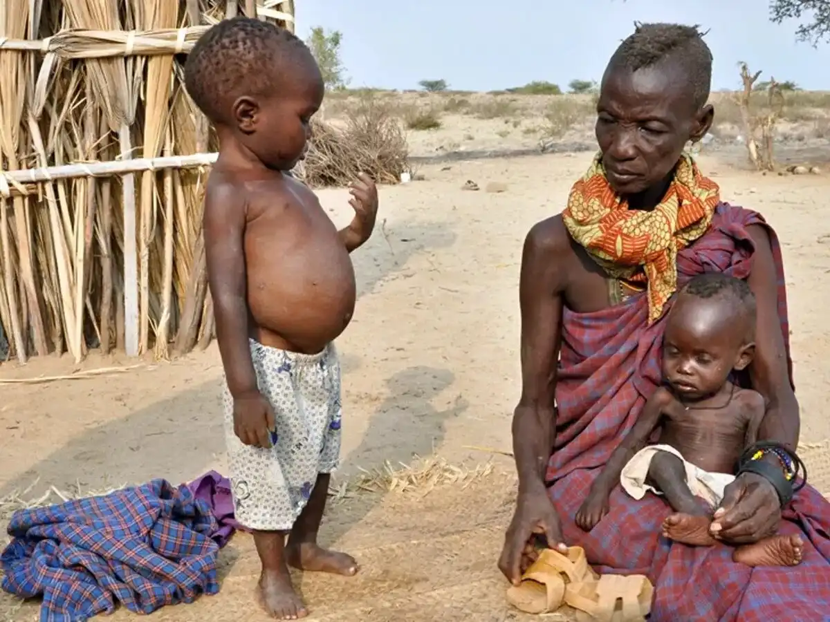 afrika, betegség, egészség, éhezés, gyerekek, klímaváltozás, szegénység, táplálkozás, társadalom, Válság